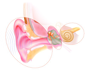 имплантируемые слуховые аппараты костной проводимости